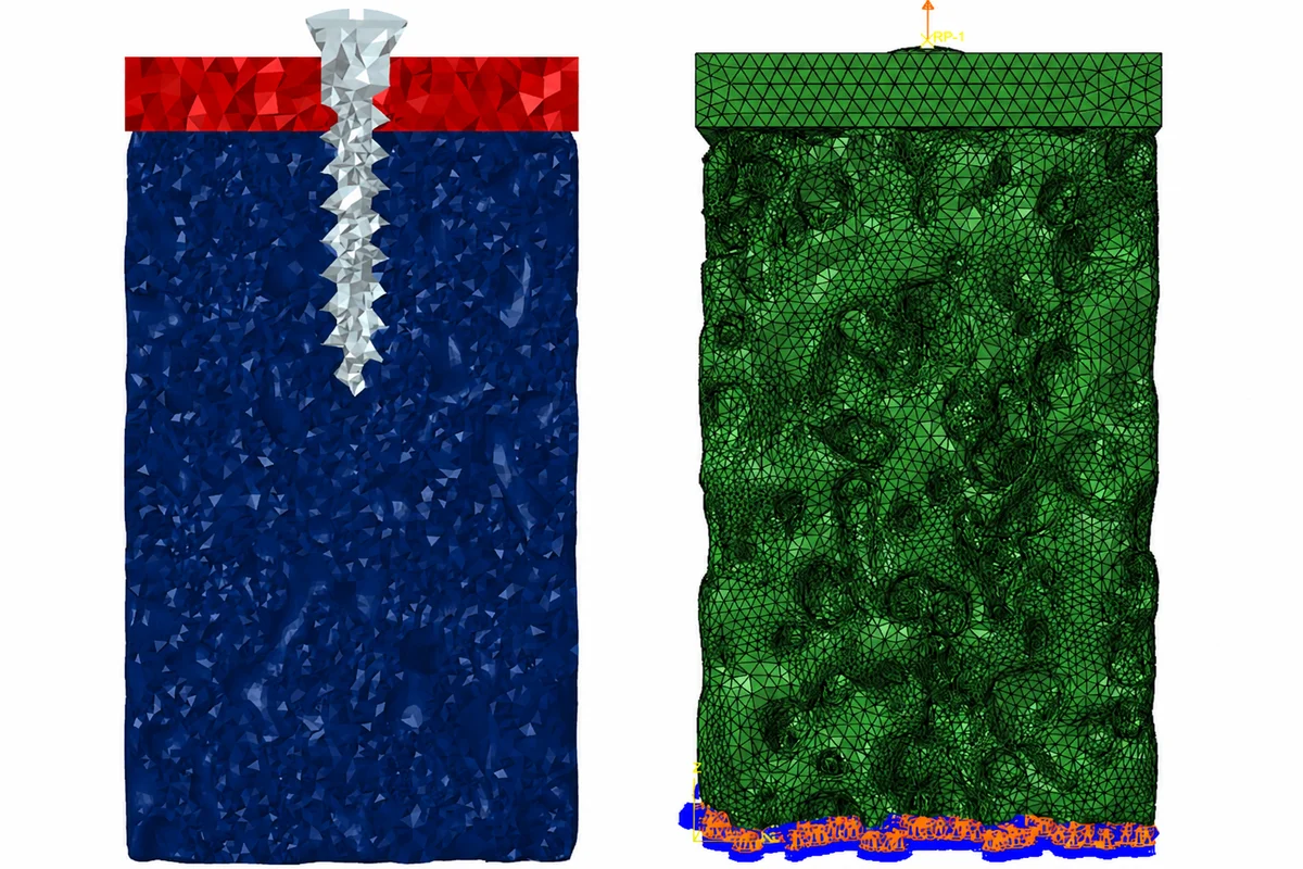 Side-by-side high-resolution bone-screw finite element models